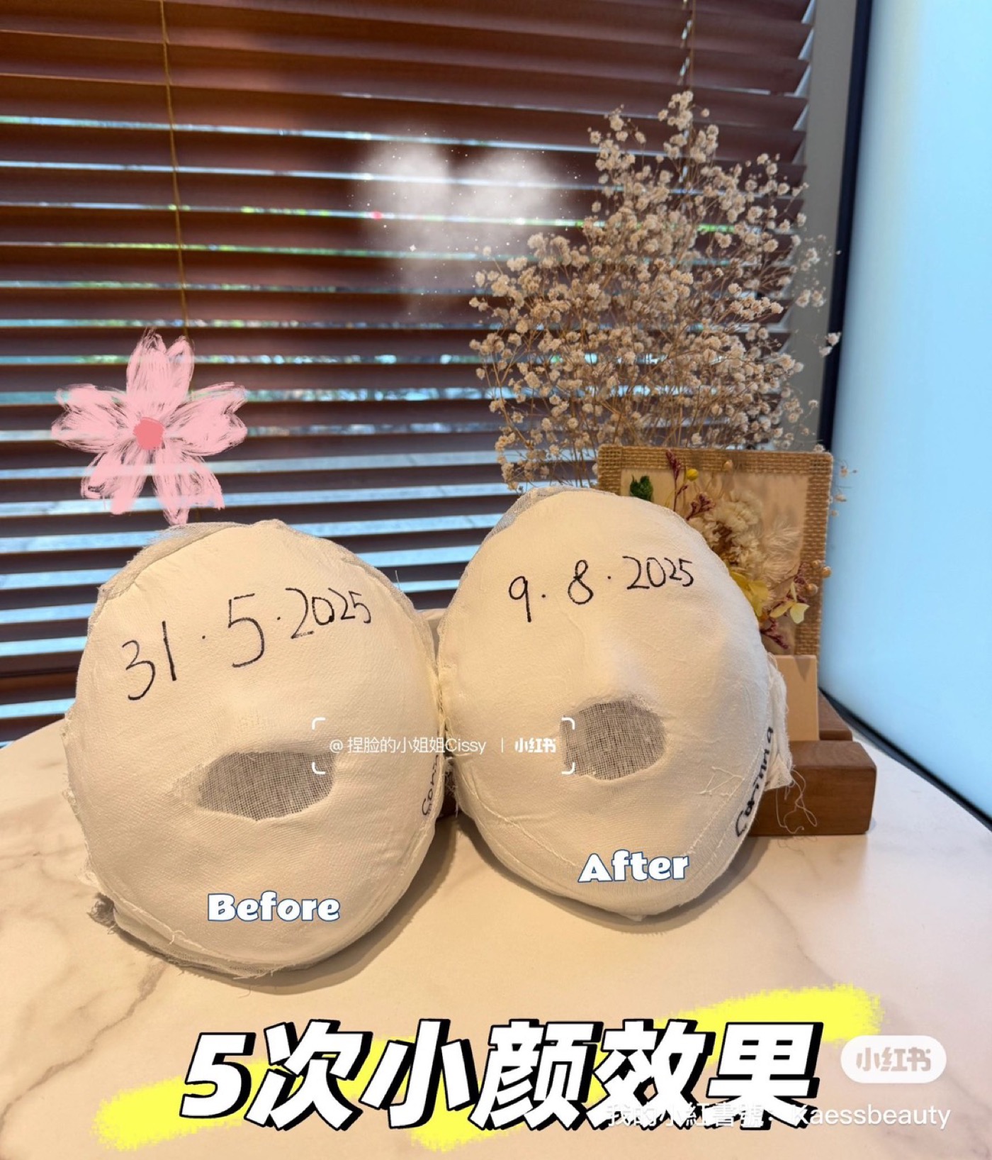 小顏療程 5 次成效