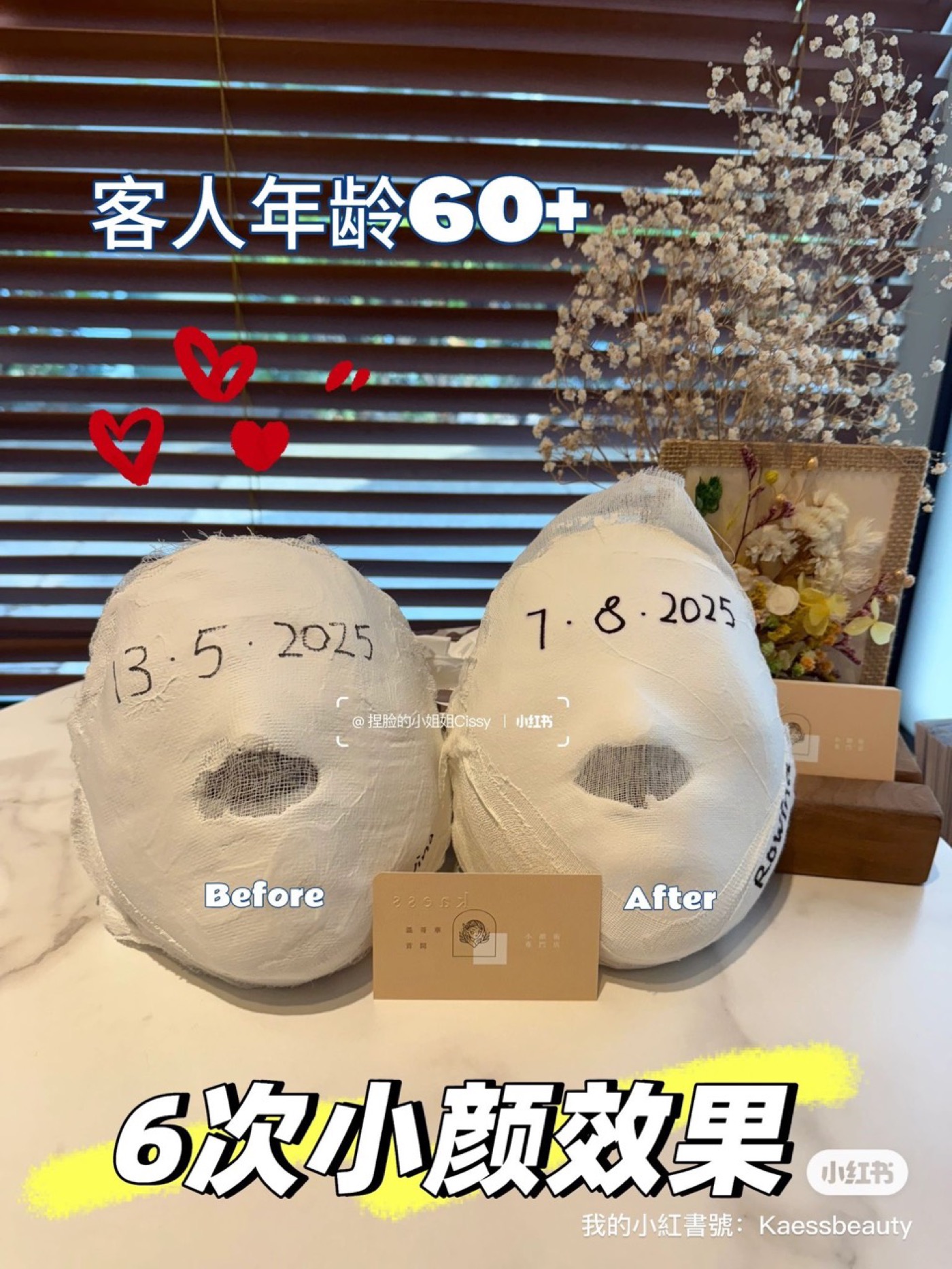 熟齡小顏成效